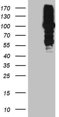 Monoclonal Mouse anti-Human MLH1 Antibody (clone OTI6E8, aa1-298, WB)