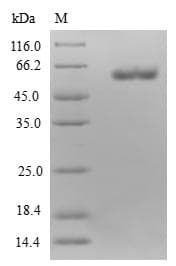 Human ETFA Protein (Recombinant GST, N-terminus)