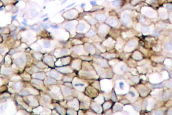 Polyclonal Rabbit anti-Human KDR / VEGFR2 / FLK1 Antibody (phospho-Tyr1175, IHC, WB)