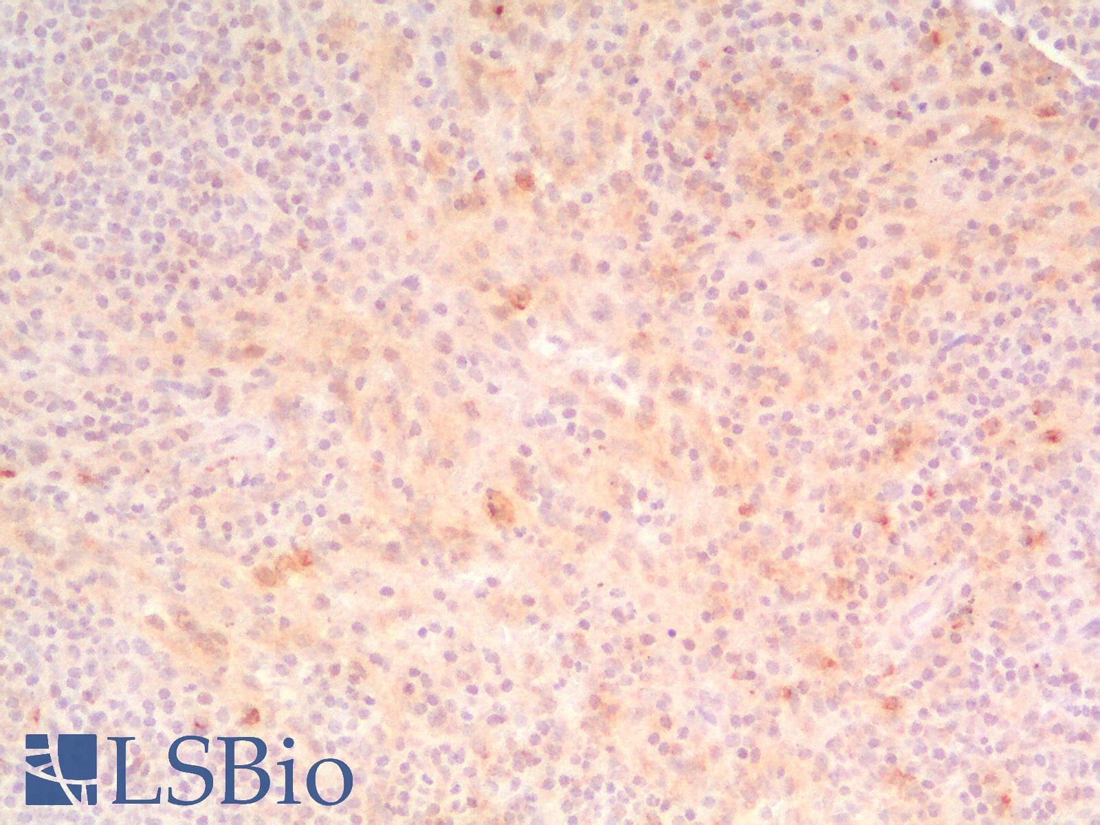 IHC-plus™ HAVCR2 / TIM-3 Antibody (Concentrated)
