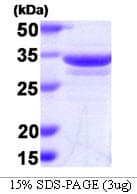 Human ANXA1 / Annexin A1 Protein (Recombinant)