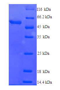 Mouse CYP2E1 Protein (Recombinant 6His, N-terminus)
