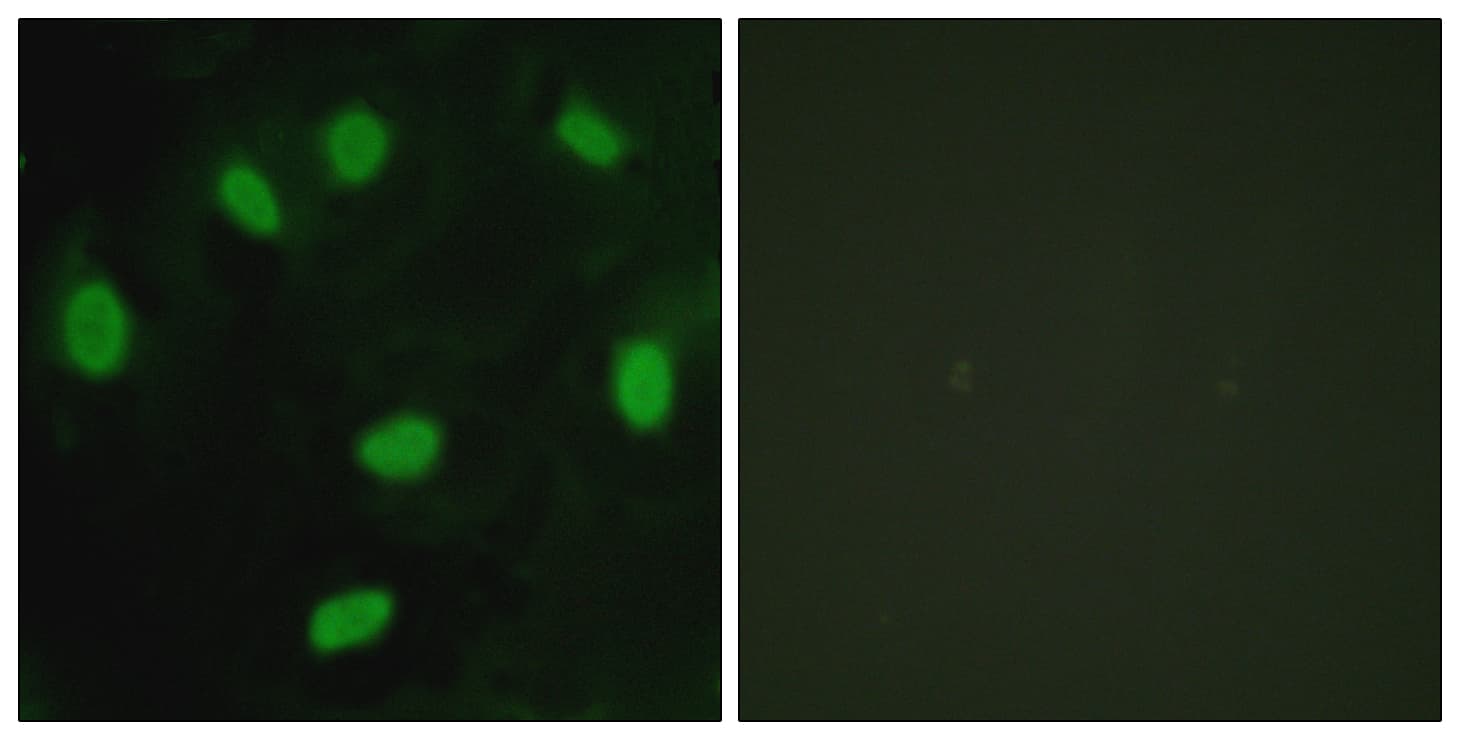 TBX15+18 Antibody (Internal)