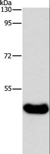 BAAT / BAT Antibody