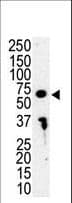 IRAK3 / IRAKM / IRAK-M Antibody (aa45-77)