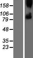 SMO / Smoothened Protein (Over-Expression Lysate Myc-DDK (Flag))