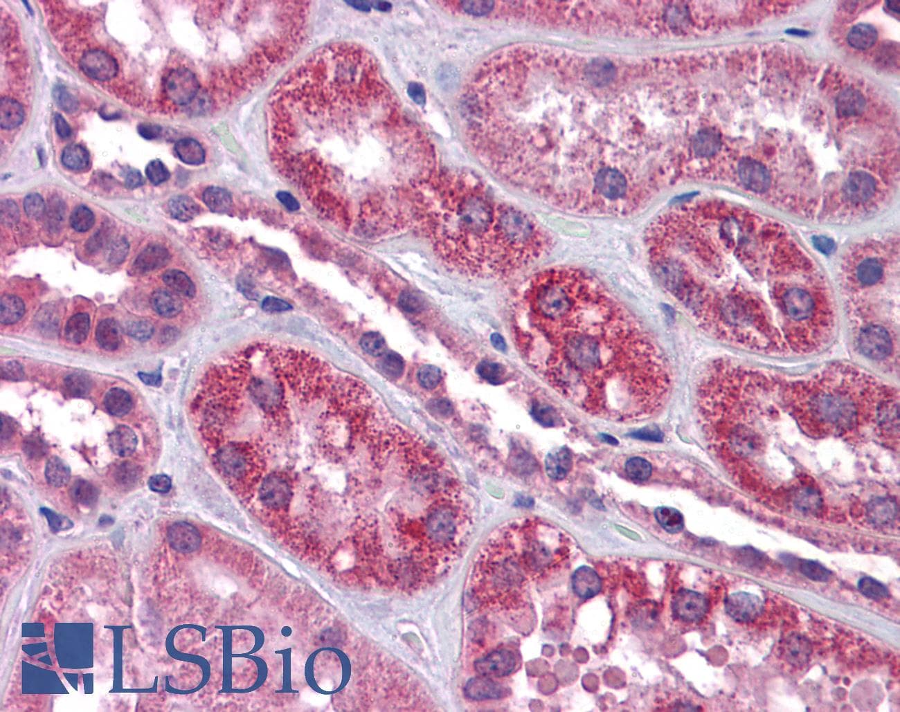 IHC-plus™ TRPC4 Antibody (aa953-965)