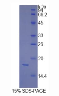 Human PDGF-CC Protein (Recombinant His-T7)