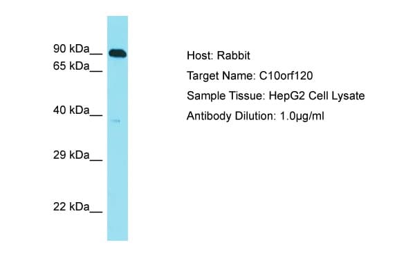 C10orf120 Antibody (aa223-272)