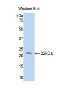 IL10RB Antibody (aa87-243)
