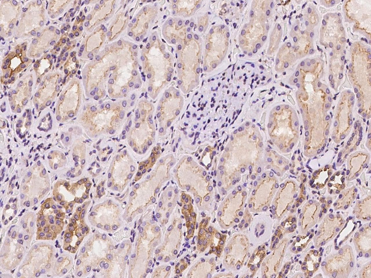 TSC22D2 Antibody