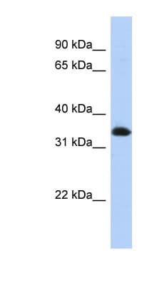 ZNF511 Antibody (N-Terminus)