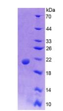 Rat MUC5AC Protein (Recombinant His-T7)