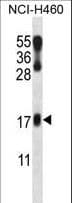 Polyclonal Rabbit anti-Human LMO2 Antibody (aa1-30, IHC, WB)