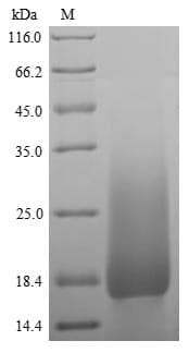Mouse Ly6g / Gr1 Protein (Recombinant 6His, N-terminus)