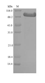 Mouse ADRBK1 / GRK2 Protein (Recombinant 6His-SUMO, N-terminus)