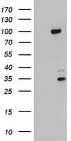 PR / Progesterone Receptor Antibody (aa1-298, clone OTI5E8)