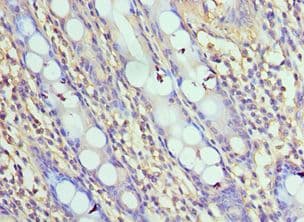 Polyclonal Rabbit anti-Human IPAF / NLRC4 Antibody (aa1-250, IHC)