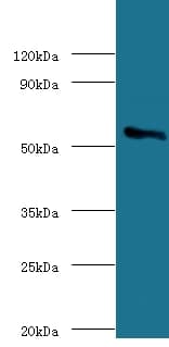 P450SCC / CYP11A1 Antibody (Biotin)
