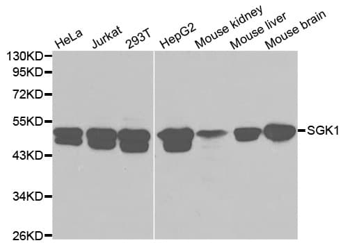 SGK1 / SGK Antibody