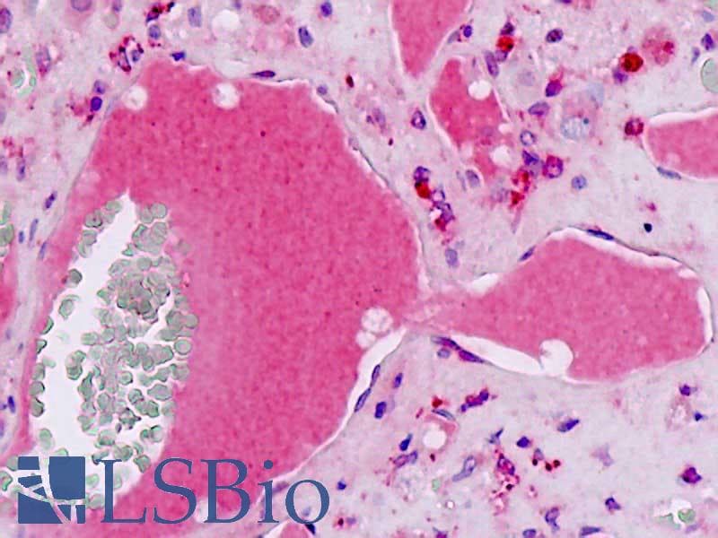 IHC-plus™ Polyclonal Rabbit anti-Human F2 / Prothrombin / Thrombin Antibody (aa278-327, IHC, WB)
