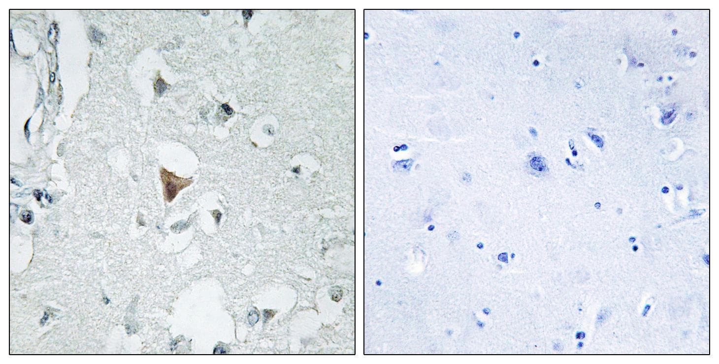 Polyclonal Rabbit anti-Human MAPK10 / JNK3 Antibody (p185, IHC, WB)