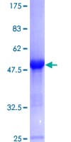 Human GLO1 / Glyoxalase I Protein (Recombinant GST)