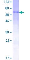 Human F7 / Factor VII Protein (Recombinant GST)