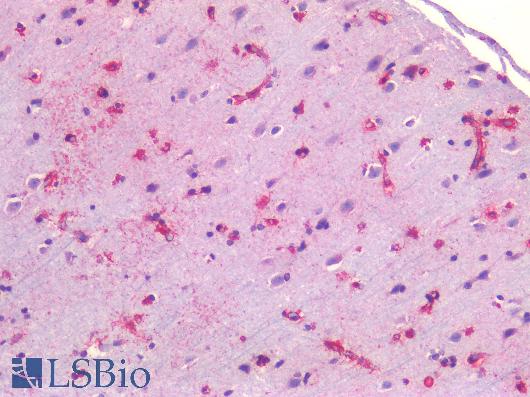 IHC-plus™ CAV1 / Caveolin 1 Antibody (N-Terminus)