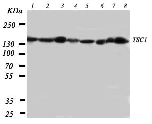 Polyclonal Rabbit anti-Human Hamartin / TSC1 Antibody (aa1150-1164, IHC, WB)