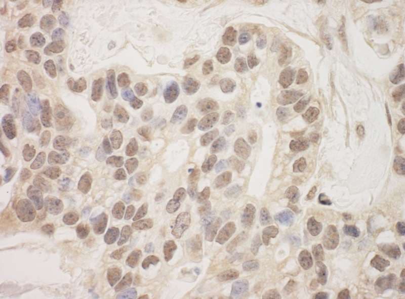 SAP130 Antibody (aa325-375)