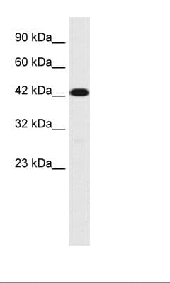 Polyclonal Rabbit anti-Human TMEM259 / Membralin Antibody (aa262-311, IHC, WB)