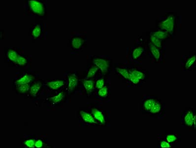 Polyclonal Rabbit anti-Human MT1E Antibody (WB)