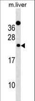 DERL2 / Derlin-2 Antibody (aa191-219)