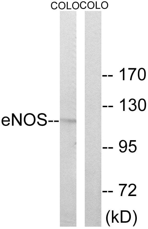 NOS3 / eNOS Antibody (p494)