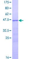 Human RSPO2 Protein (Recombinant GST)