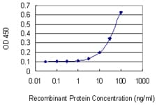 Monoclonal Mouse anti-Human XRCC3 Antibody (clone 1H7)