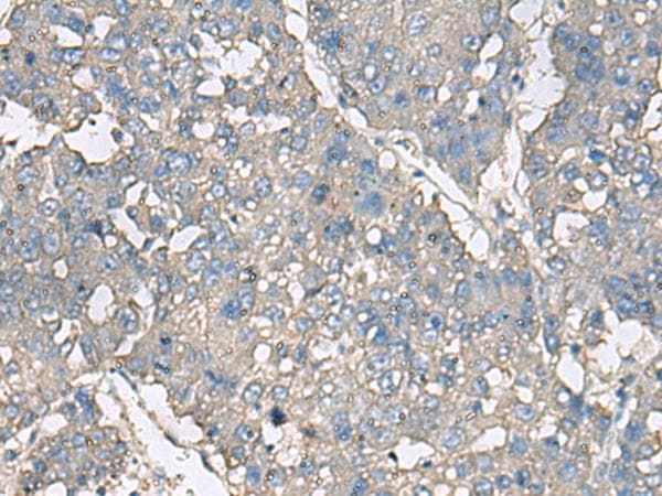 Polyclonal Rabbit anti-Human TNF Alpha Antibody (IHC)