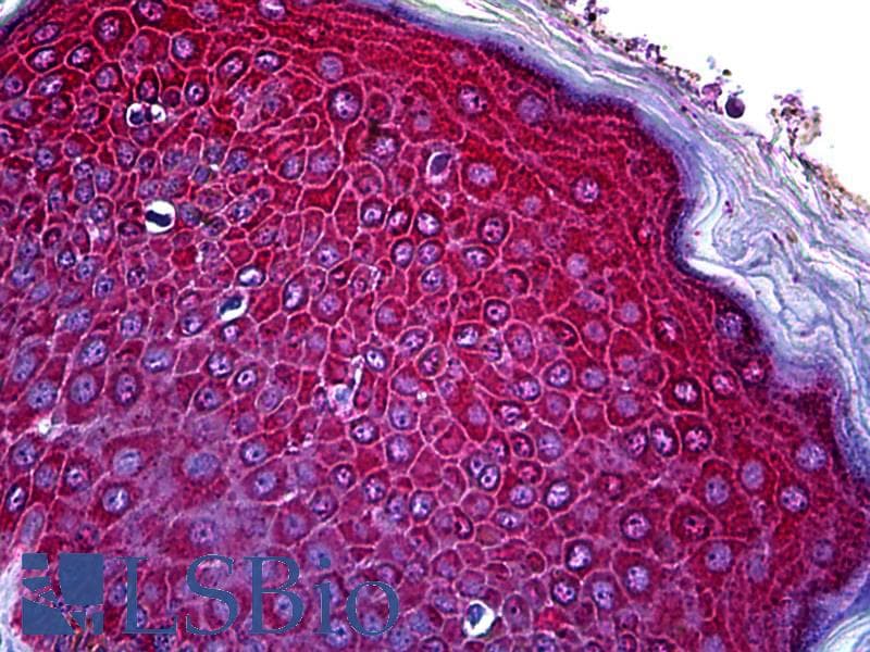 IHC-plus™ Polyclonal Rabbit anti-Human CCR3 Antibody (N-Terminus, IHC, WB)