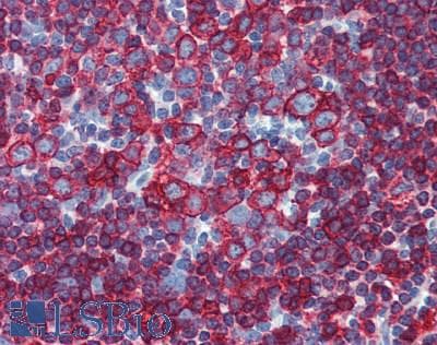 IHC-plus™ HLA-DP/DR Antibody (clone HL-40)