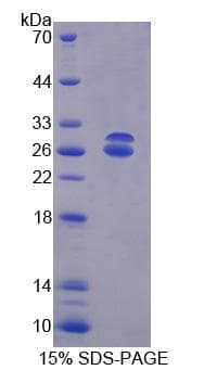 Mouse ABCG5 Protein (Recombinant)