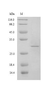 Hepatitis E Virus Capsid Protein VP1 (Recombinant 6His, N-terminus)