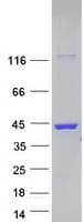 Human LGALS8 / Galectin 8 Protein (Recombinant Myc-DDK (Flag))