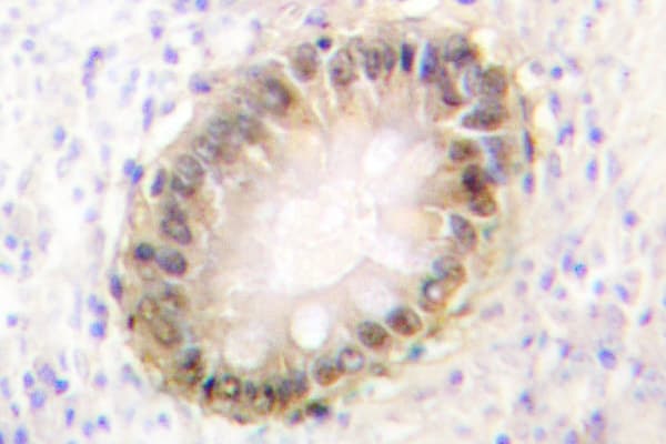 SMAD2+3 Antibody (Ser2)