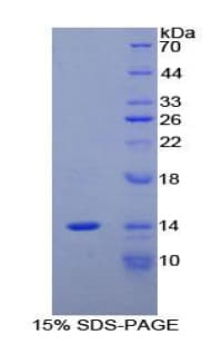Mouse CCL24 / Eotaxin 2 Protein (Recombinant His)