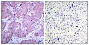 Polyclonal Rabbit anti-Human PTEN Antibody (phospho-Ser380, IHC, WB)