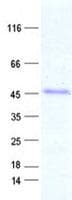 Human NEUROD4 Protein (Recombinant His, N-Terminal)