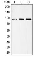 Polyclonal Rabbit anti-Human TLR4 Antibody (Internal, WB)