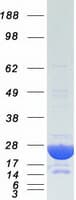 Human CRYAB / Alpha B Crystallin Protein (Recombinant Myc-DDK (Flag))