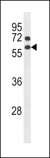 CCNB1 / Cyclin B1 Antibody (aa155-182)